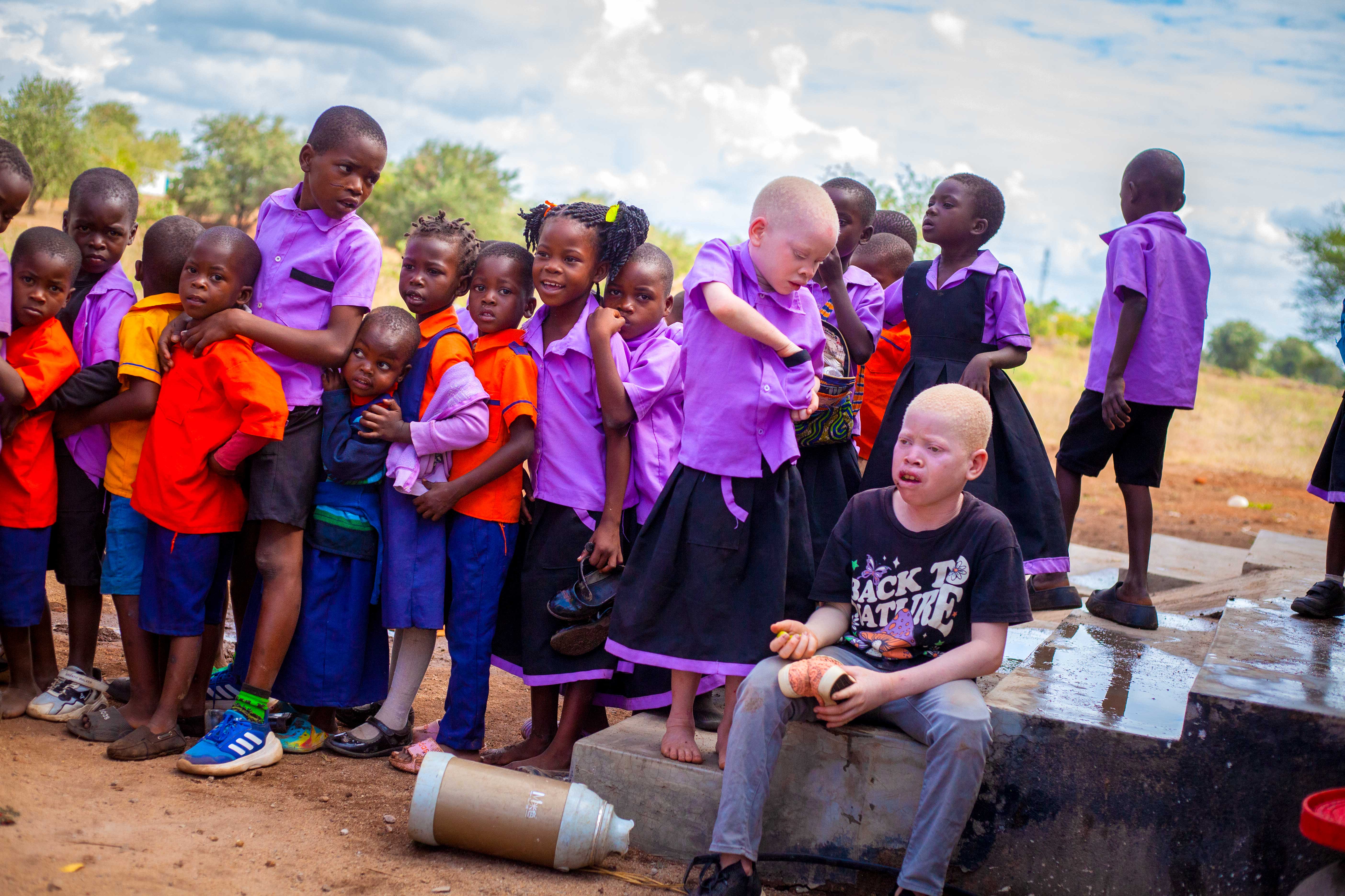Children, including children with albinism, gathered at Pashello