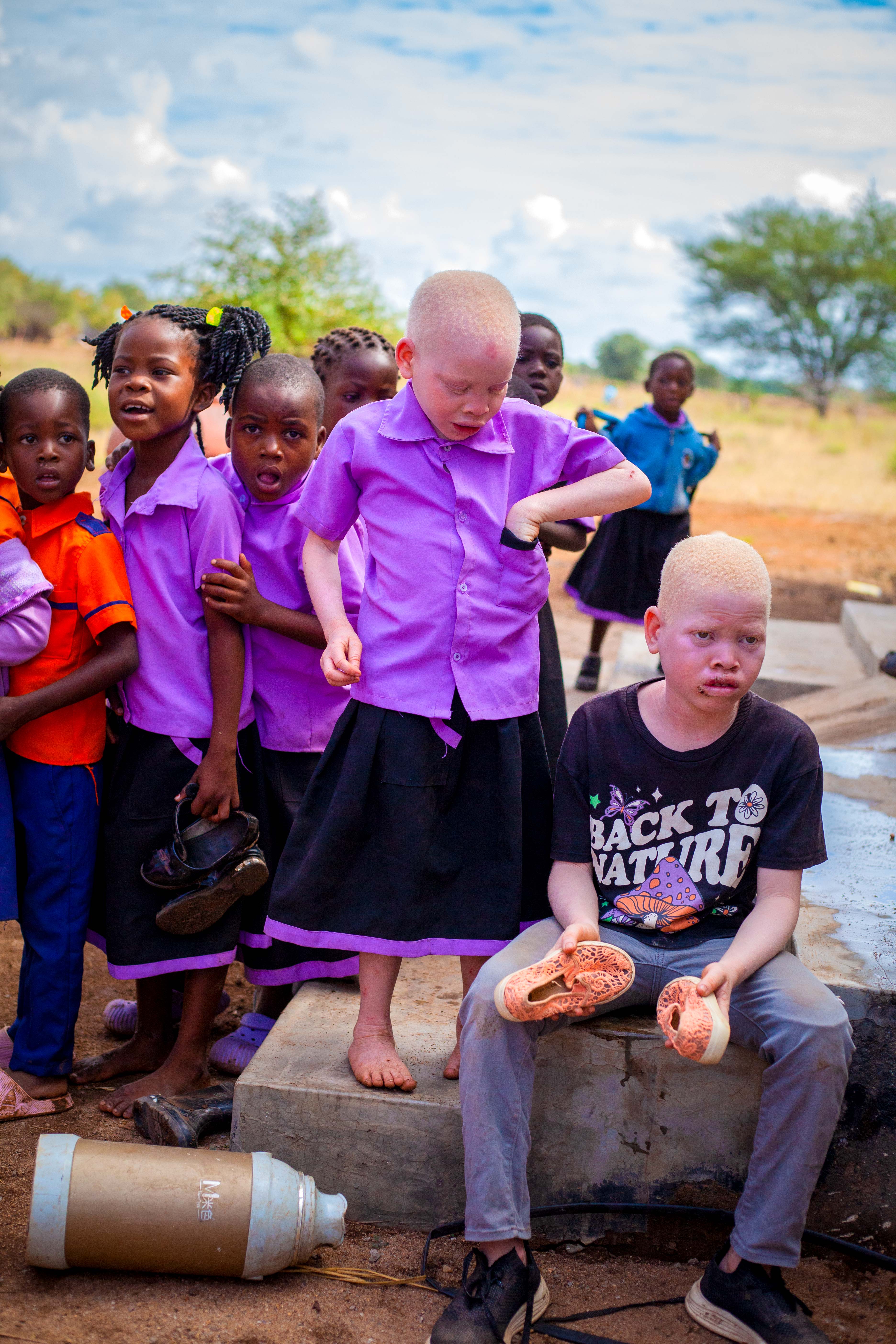 Young people supported by Pashello albinism programme
